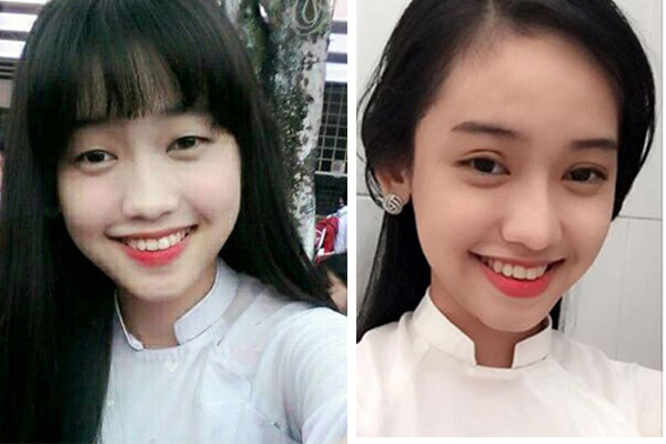 Before and After 2