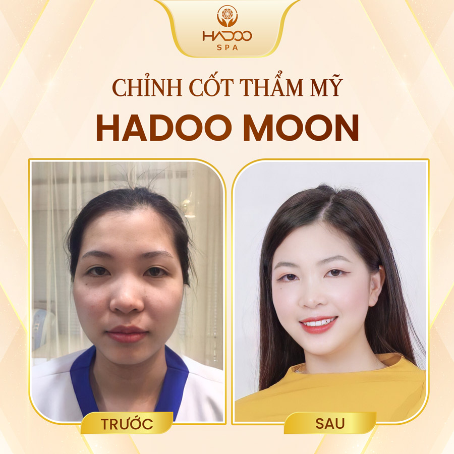 Hadoo Moon 1