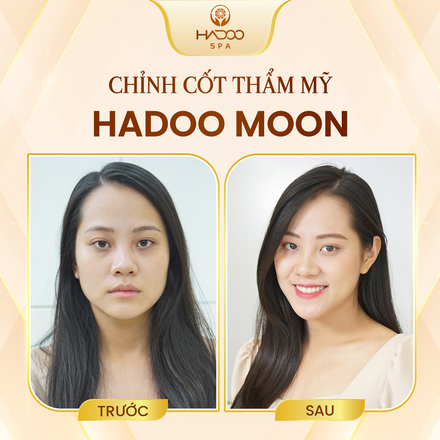 Hadoo Moon 2