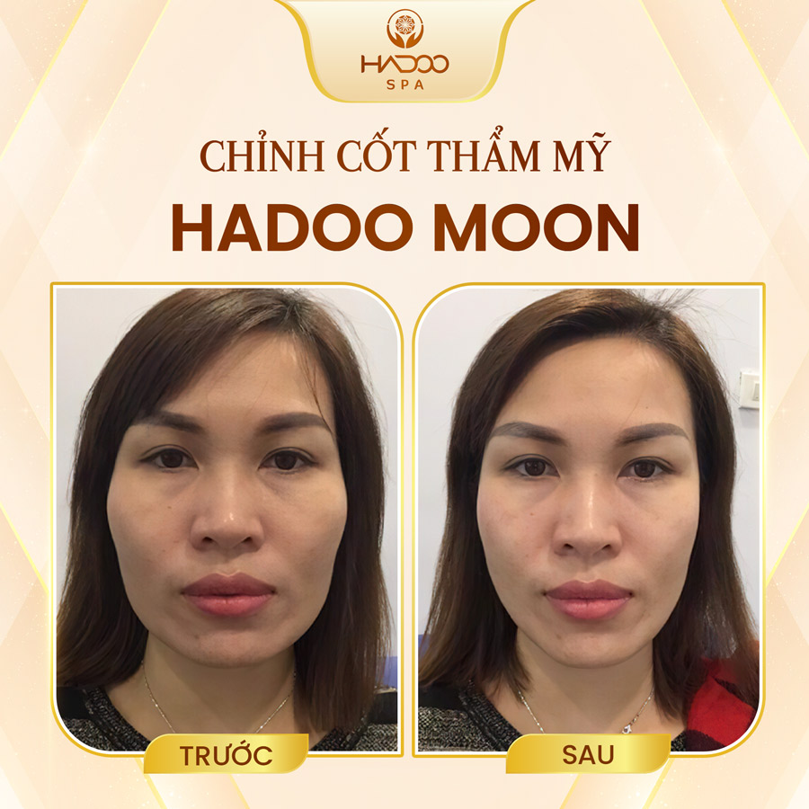 Hadoo Moon 3