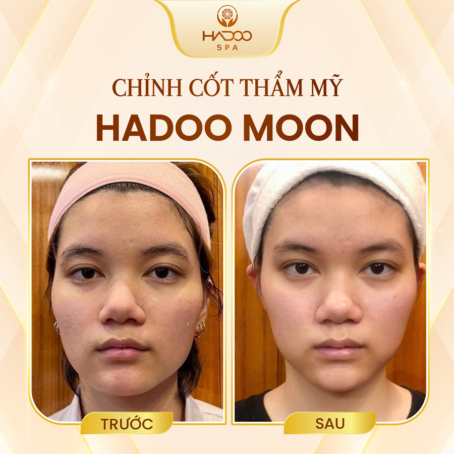 Hadoo Moon 5