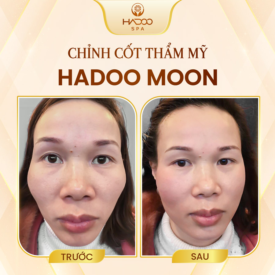 Hadoo Moon 6