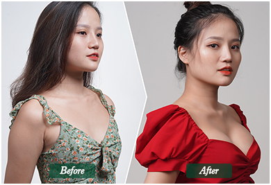 Before and After